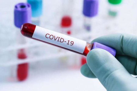 Azərbaycanda daha 43 nəfərdə koronavirus aşkarlandı - RƏSMİ