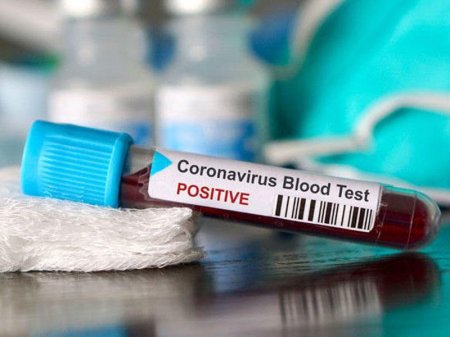 Azərbaycanda koronavirusdan daha üç nəfər öldü, 202 xəstə sağaldı - RƏSMİ
